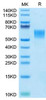 Recombinant Human ENPP-3(558-875) Protein (RPCB1756)