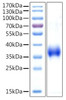 Recombinant Human Cathepsin L Protein (RPCB1760)