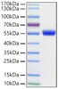 Recombinant Human NSE/ENO2 Protein (RPCB1761)