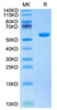 Biotinylated Recombinant  Human HBV(HLA-A*02:01) Protein (RPCB1770)