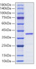 Recombinant Human Lactate Dehydrogenase A/LDHA Protein (RPCB1773)
