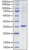 Recombinant Human Proliferating cell nuclear antigen/PCNA Protein (RPCB1784)