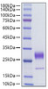 Recombinant Human FGF-7/HBGF-7/KGF Protein (RPCB1793)