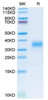 Recombinant Human DHLAG/CD74 Protein (RPCB1805)