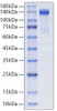 Recombinant Human PSMA/FOLH1 Protein (RPCB1806)