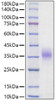 Recombinant Mouse Erythropoietin/EPO Protein (RPCB1810)