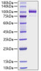 Recombinant Human Periostin/PN/POSTN Protein (RPCB1813)