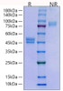 Recombinant Human WFDC2/HE4/WAP5 Protein (RPCB1822)