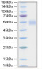 Recombinant Human Lp-PLA2/PLA2G7 Protein (RPCB1842)