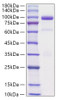Recombinant Rat Hepatocyte growth factor/HGF Protein (RPCB1844)