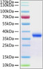 Recombinant Human Aldehyde reductase/AKR1B1 Protein (RPCB1858)