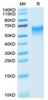 Recombinant Mouse LEU3/CD4 Protein (RPCB1859)