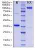 Recombinant Human Collagen II alpha 1/COL2A1 Protein (RPCB1861)