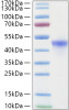 Recombinant Human RRM2 Protein (RPCB1863)