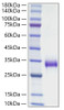 Recombinant Mouse TIMP-1 Protein (RPCB1871)