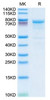 Recombinant Human Plasma Kallikrein/KLKB1 Protein (RPCB1881)
