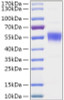 Recombinant Human CNDP2 Protein (RPCB1888)