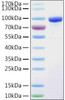 Recombinant Human PPAR gamma Protein (RPCB1894)