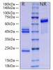 Recombinant Mouse IL-23/IL-12B&IL-23A Protein (RPCB1900)