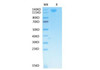 Biotinylated Recombinant SARS-CoV Spike S1 Protein (RPCB1914)