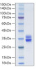 Recombinant Human MMP-7 Protein (RPCB1918)