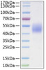 Recombinant Mouse Follistatin-like protein 1/FSTL1 Protein (RPCB1925)