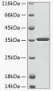 Recombinant Human Aminoacylase-3/ACY 3 Protein (RPCB1928)