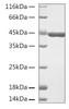 Recombinant Human Beta-actin/ACTB Protein (RPCB1932)