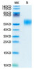 Recombinant Mouse CSF2RA/GM-CSF R alpha/CD116 Protein (RPCB1948)
