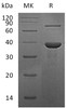 Recombinant Human Retinol-binding protein 3/RBP3 Protein (RPCB1950)