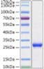 Recombinant Human Histone H1 Protein (RPCB1951)