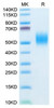 Recombinant Mouse FGFR-2 beta (IIIb)/KGFR/CD332 Protein (RPCB1952)
