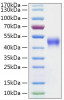 Recombinant Mouse IL-2 R beta/CD122 Protein (RPCB1978)