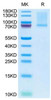 Recombinant Mouse GAS-6 Protein (RPCB1983)