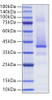 Recombinant Human IGF-II Protein (RPCB2009)