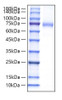 Recombinant Mouse Endoglin/ENG/CD105 Protein (RPCB2014)