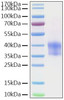 Recombinant Mouse Cathepsin B Protein (RPCB2023)