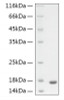Recombinant Human GFAP protein (RPCB2028)