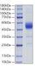 Recombinant Rat ALK-1/ACVRL1 Protein (RPCB2030)