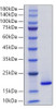 Recombinant Human Phospholipase A2/PLA2G1B Protein (RPCB2041)