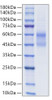 Recombinant Human IgD  Protein (RPCB2063)