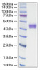 Recombinant Human IgE Protein (RPCB2071)