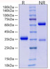 Recombinant Human IgG4 Protein (RPCB2073)