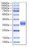 Recombinant Human IgM Protein (RPCB2082)