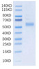 Recombinant Human DLL3 Protein (RPCB2086)