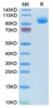 Recombinant Mouse Interferon alpha/beta receptor 1/IFNAR1 Protein (RPCB2090)