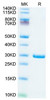 Recombinant SARS-COV-2 NSP7&NSP8 Protein (RPCB2093)