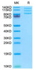 Recombinant Mouse Integrin alpha V beta 8 (ITGAV&ITGB8) Heterodimer Protein (RPCB2094)