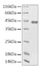 Recombinant Human Creatine Kinase MM/CKMM Protein (RPCB2115)