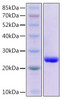 Recombinant Human GPX4 Protein (RPCB2117)
